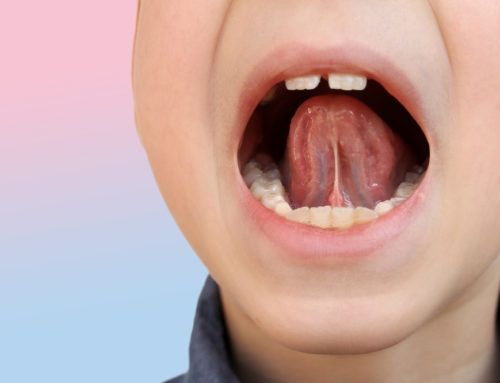 Understanding Frenectomy: A Complete Guide to Procedure and Benefits