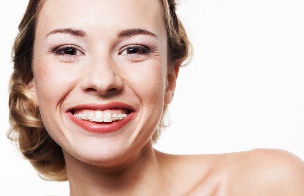 A woman with braces. Here are 5 reasons you should get braces as an adult