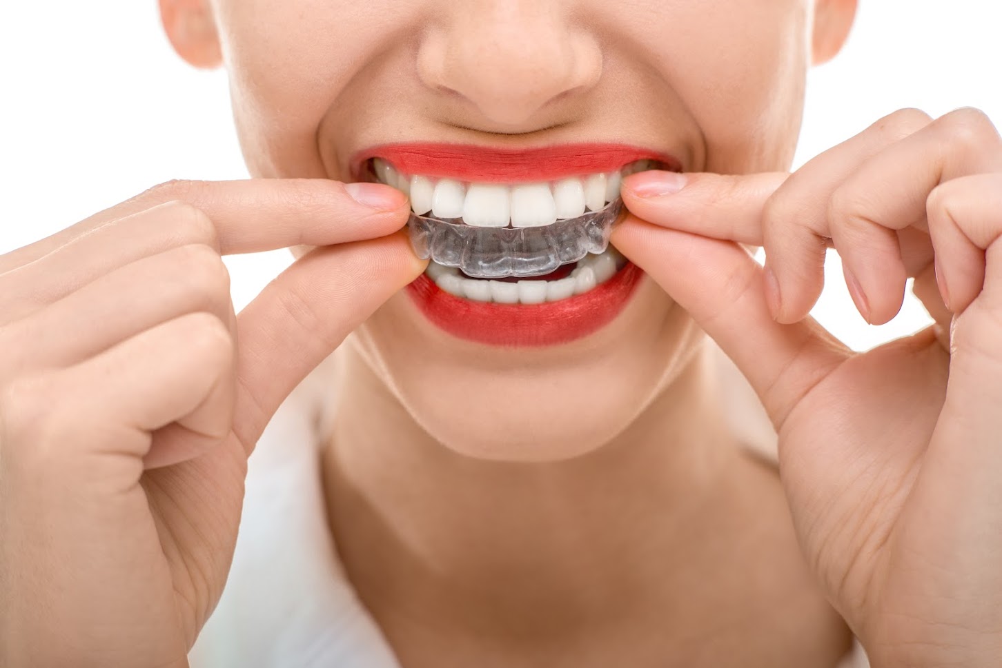 Learn the Myths About Invisalign from Snodgrass-King pediatric dentistry in tennessee