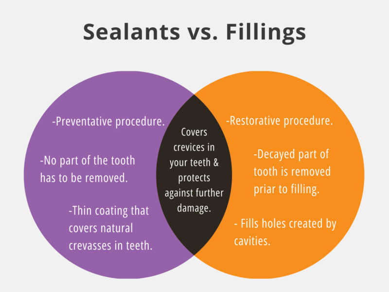Sealants vs. Fillings What
