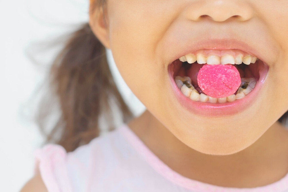 Sugar causes cavities on teeth of not cleaned off quickly