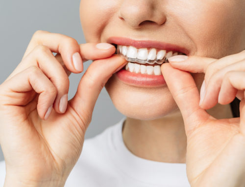 Facts To Consider When Whitening Your Teeth